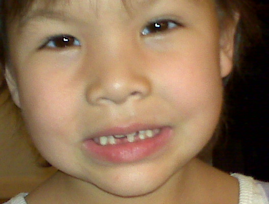 firsttooth